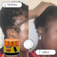 Thumbnail for Before and after comparison of hair care product application on a person's scalp with a jar of product displayed.