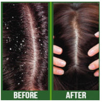 Thumbnail for DIFEEL 99% NATURAL PREMIUM CASTOR  PLUS  TEA TREE-PRO-GROWTH+SCALP CARE HAIL OIL- 2.5 OZ