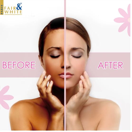 FAIR & WHITE So White Hydra Sweet Moisturizing Body Lotion w Almond Oil (500ml / 17.6 oz)
Sareya Beauty Supply Store in Calgary Alberta Canada